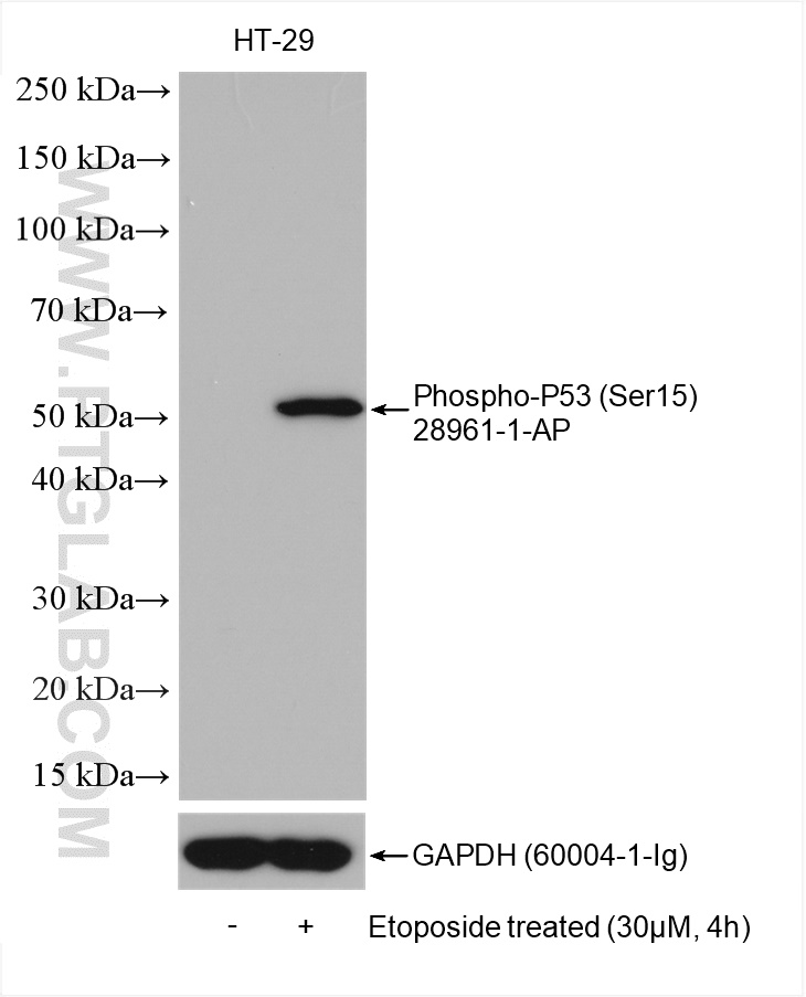 Phospho-P53 (Ser15)