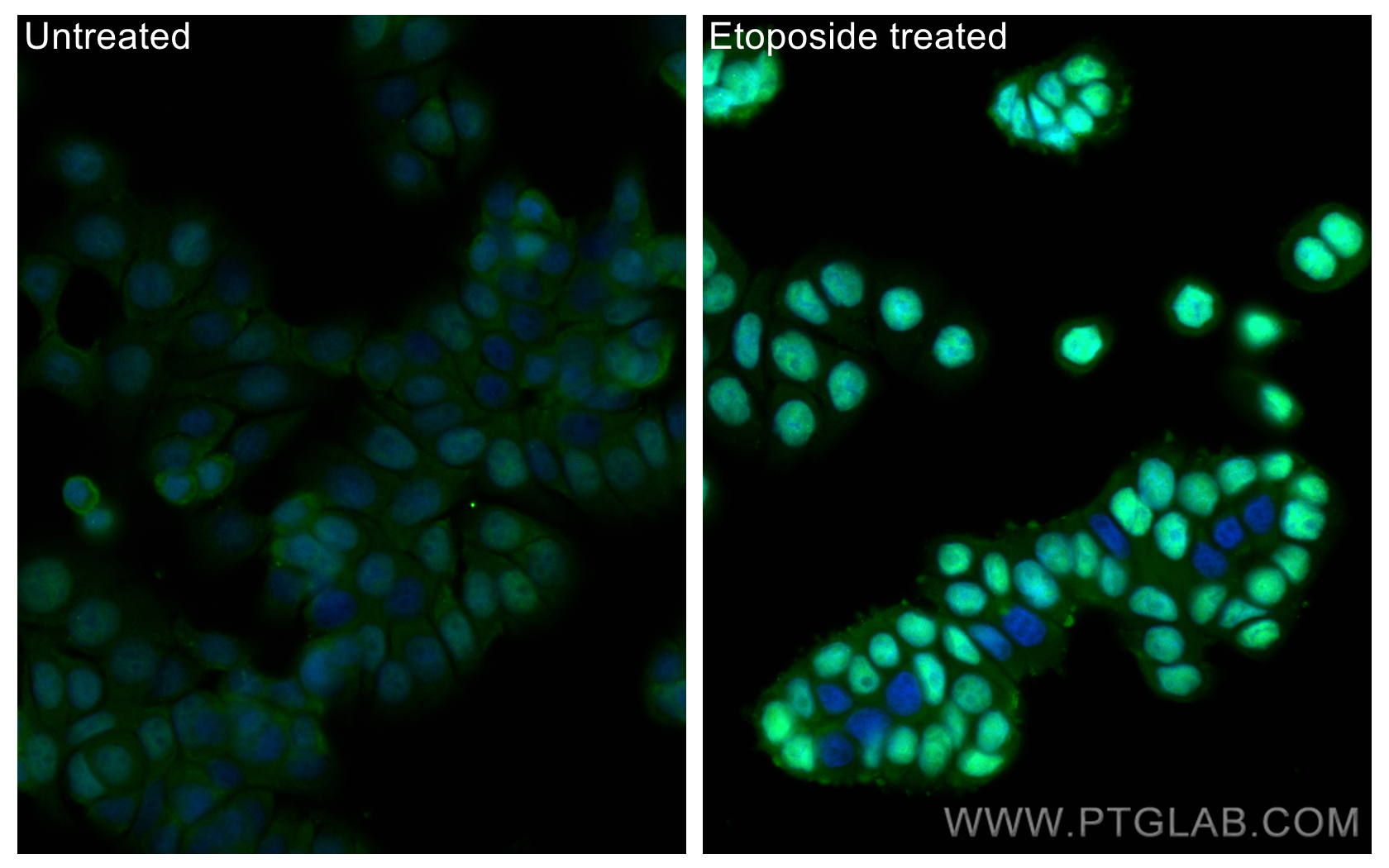 IF Staining of HT-29 using CL488-80195