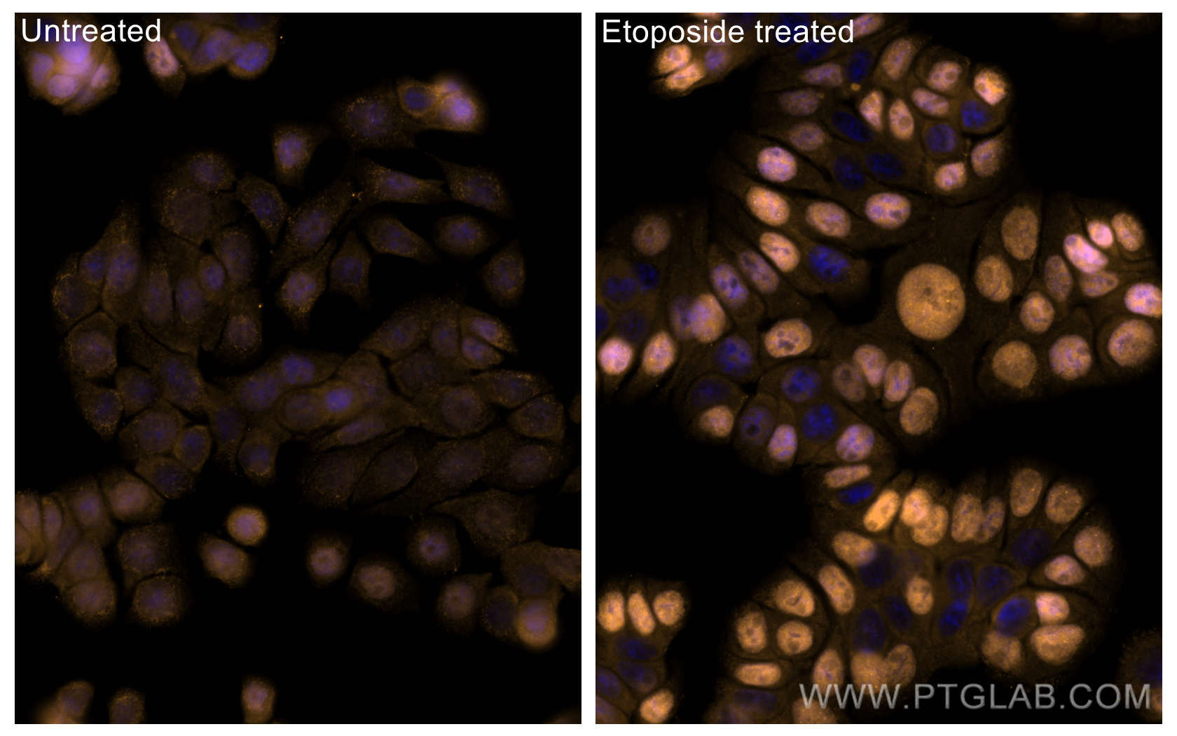 IF Staining of HT-29 using CL555-80195