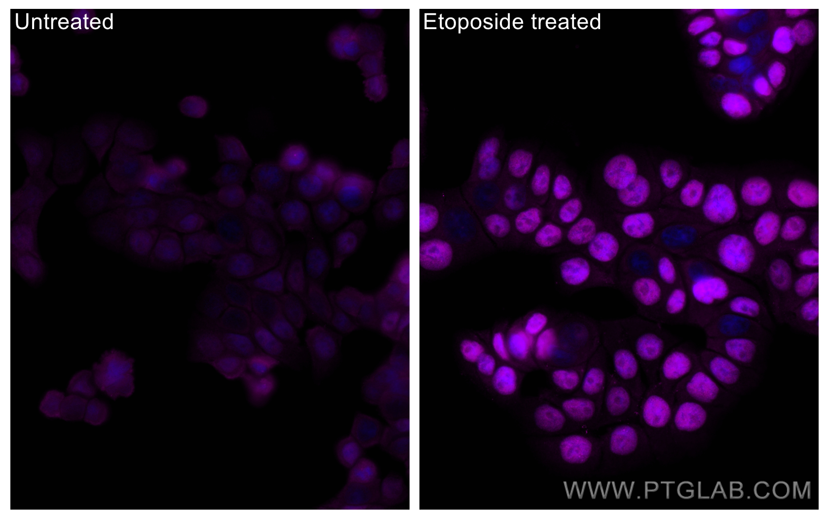 IF Staining of HT-29 using CL647-80195