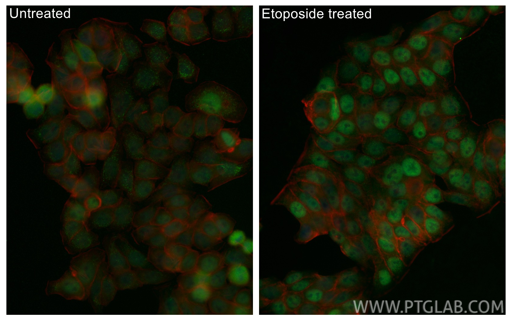 IF Staining of HT-29 using CL488-80077-9