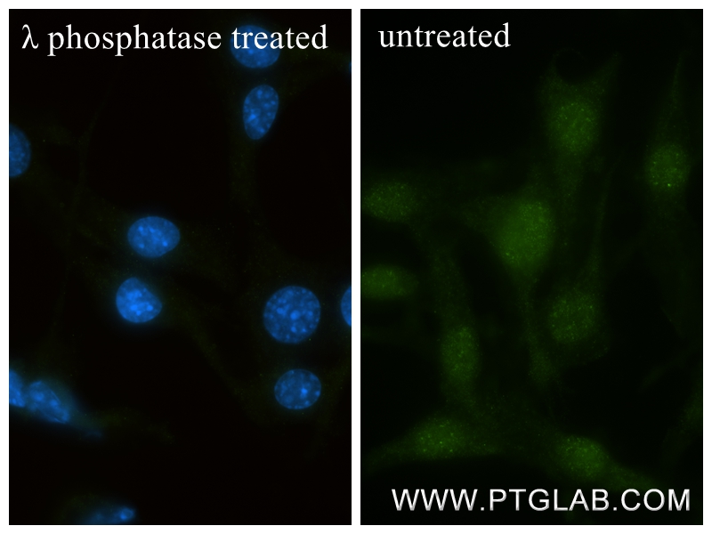 IF Staining of NIH/3T3 using 80294-2-RR IF Staining of NIH/3T3 using 80294-2-RR