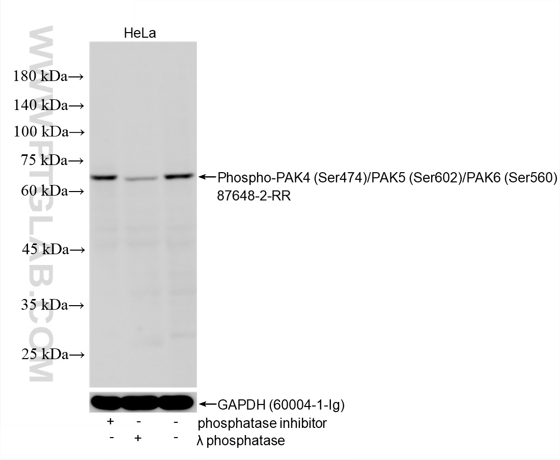 WB analysis using 87648-2-RR (same clone as 87648-2-PBS)