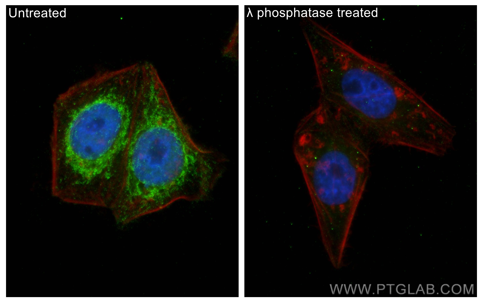 IF Staining of HepG2 using 29582-1-AP