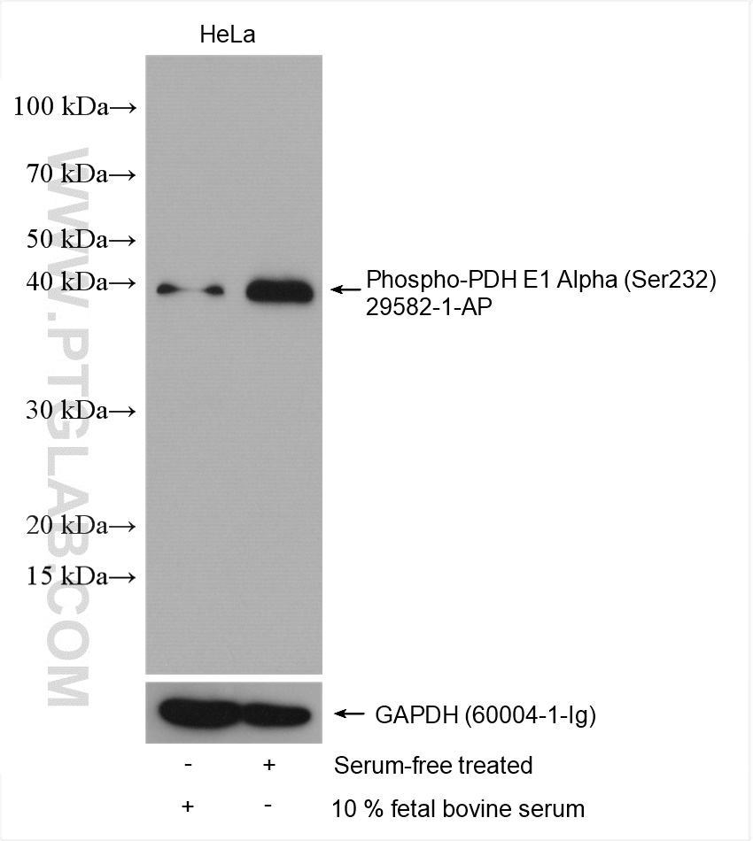 Phospho-PDH E1 Alpha (Ser232)