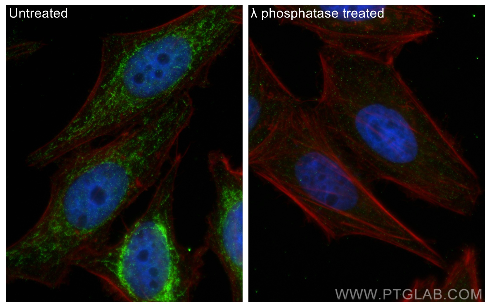 IF Staining of HepG2 using 29583-1-AP (same clone as 29583-1-PBS)