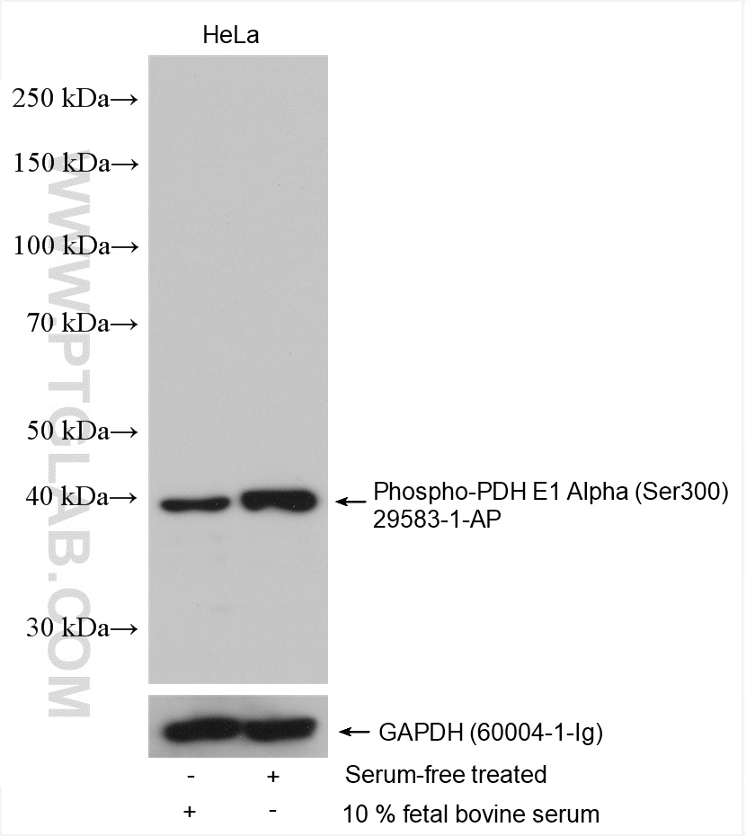 Phospho-PDH E1 Alpha (Ser300)