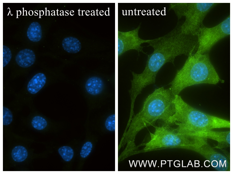 IF Staining of NIH/3T3 using 85223-3-RR
