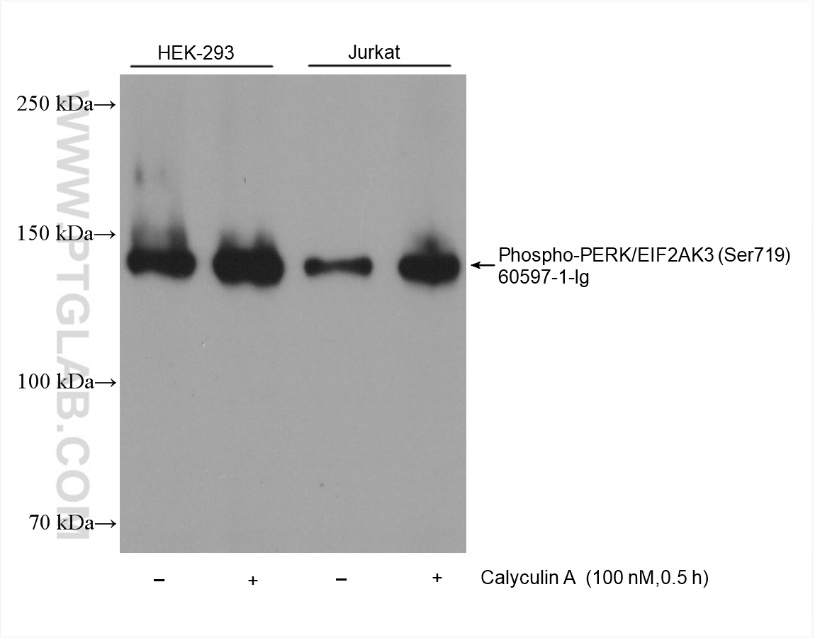 WB analysis using 60597-1-Ig (same clone as 60597-1-PBS)