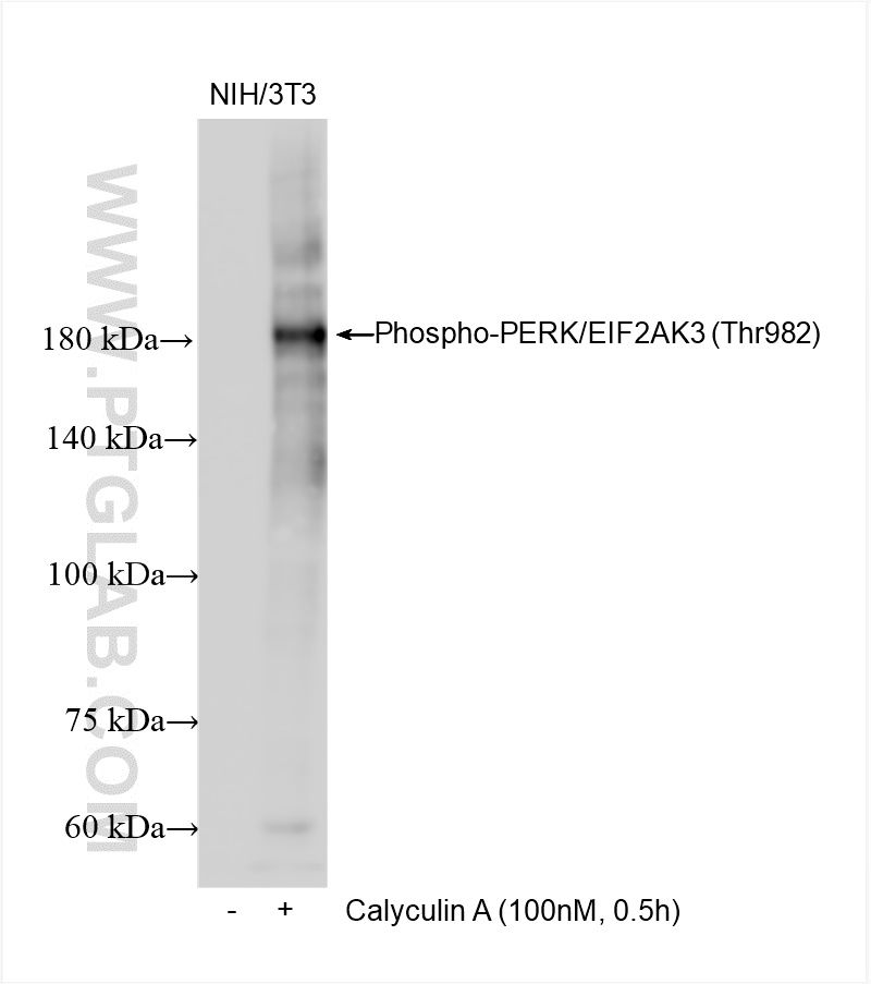 Phospho-PERK/EIF2AK3 (Thr982)