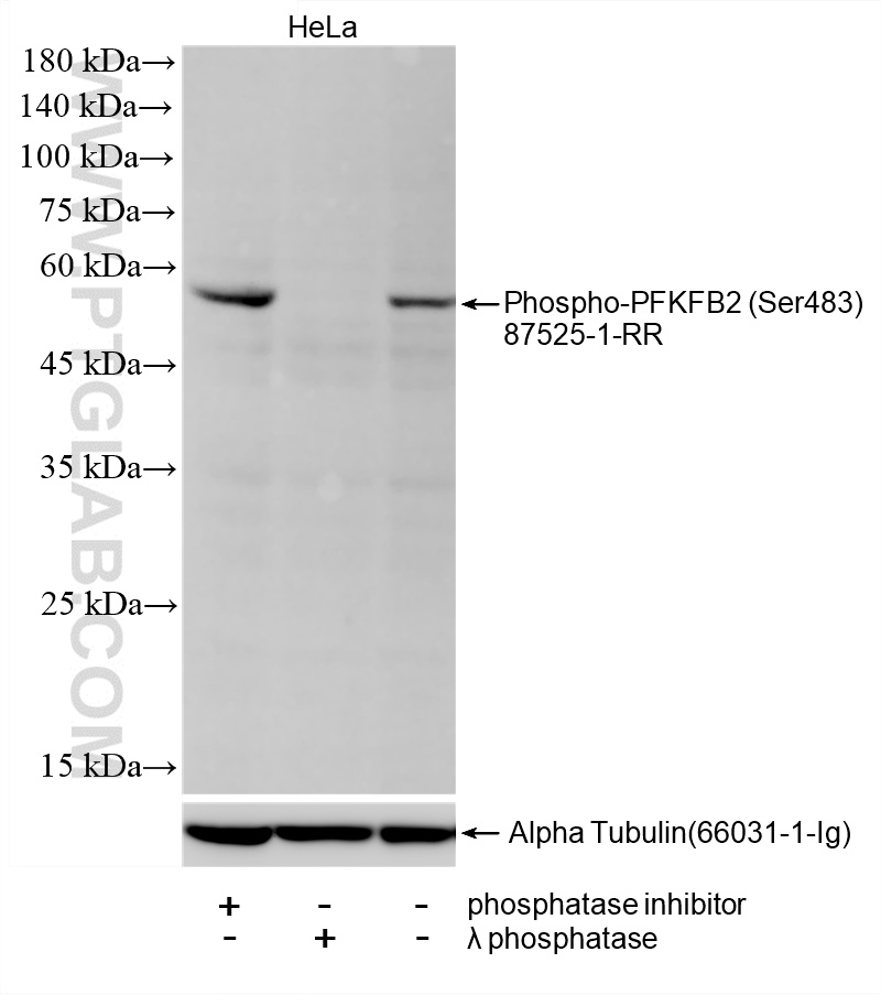 Non-treated HeLa cells, phosphatase inhibitor treated HeLa cells and λ phosphatase treated HeLa cells were subjected to SDS PAGE followed by western blot with <a class='green' href='/productredirect?CatalogNo=87525-1-RR' target='_blank'>87525-1-RR</a> (Phospho-PFKFB2 (Ser483) antibody) at dilution of 1:2000 incubated at room temperature for 1.5 hours. The membrane was stripped and re-blotted with Alpha Tubulin (<a class='green' href='/productredirect?CatalogNo=66031-1-Ig' target='_blank'>66031-1-Ig</a>) antibody as a loading control. This data was developed using the same antibody clone with 87525-1-PBS in a different storage buffer formulation. WB analysis of HeLa using 87525-1-RR (same clone as 87525-1-PBS)