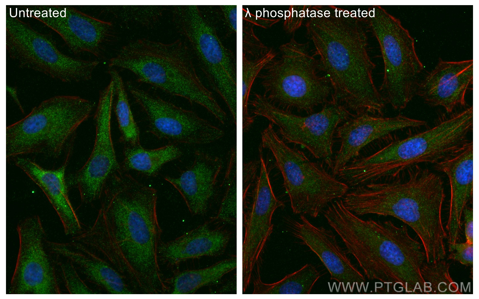 IF Staining of HeLa using 28926-1-AP