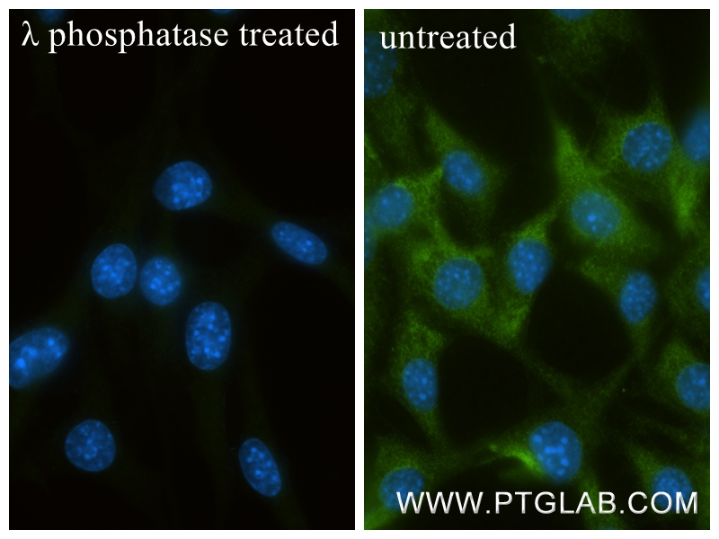 IF Staining of NIH/3T3 using 83840-7-RR