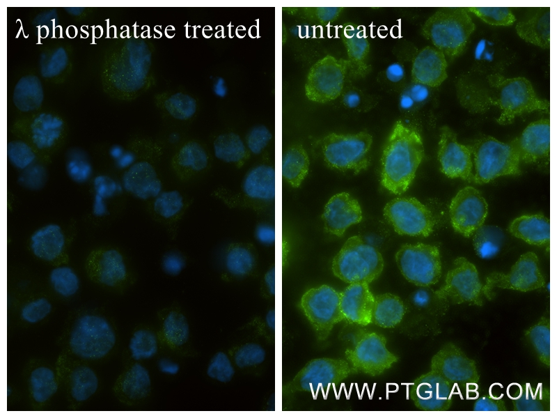 Immunofluorescent analysis of (4% PFA) fixed λ phosphatase treated THP-1 cells using Phospho-PKC Alpha (Thr638) antibody (81575-2-RR, Clone: 241844A10 ) at dilution of 1:400 and CoraLite®488-Conjugated Goat Anti-Rabbit IgG(H+L) (<a class='green' href='/productredirect?CatalogNo=SA00013-2' target='_blank'>SA00013-2</a>). IF Staining of THP-1 using 81575-2-RR