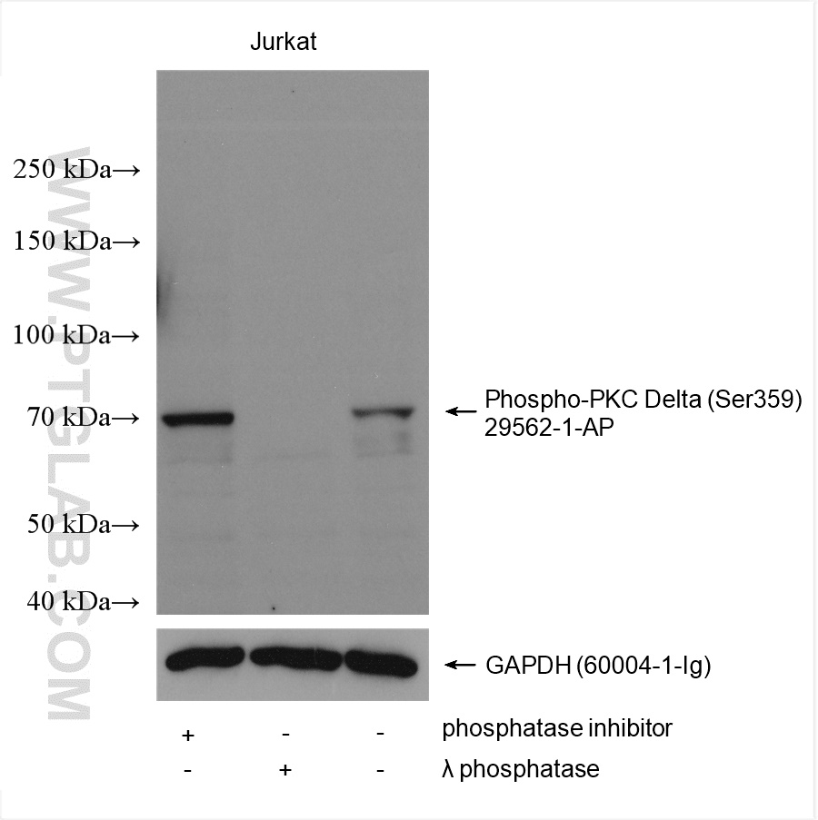 WB analysis using 29562-1-AP