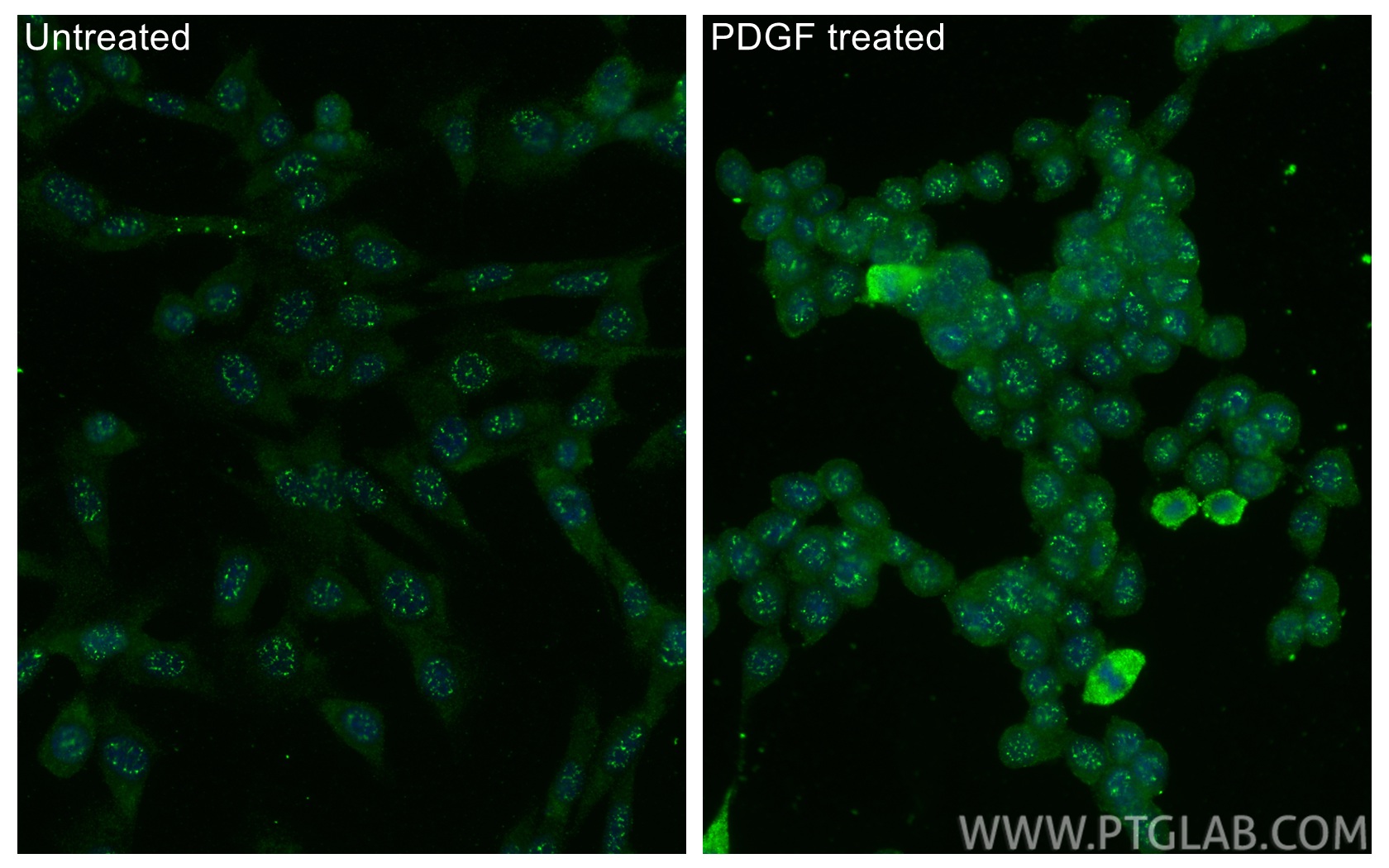 IF Staining of NIH/3T3 using 29107-1-AP