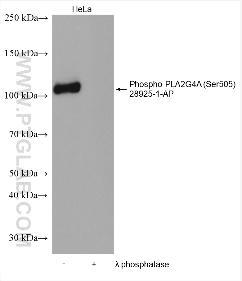 WB analysis using 28925-1-AP