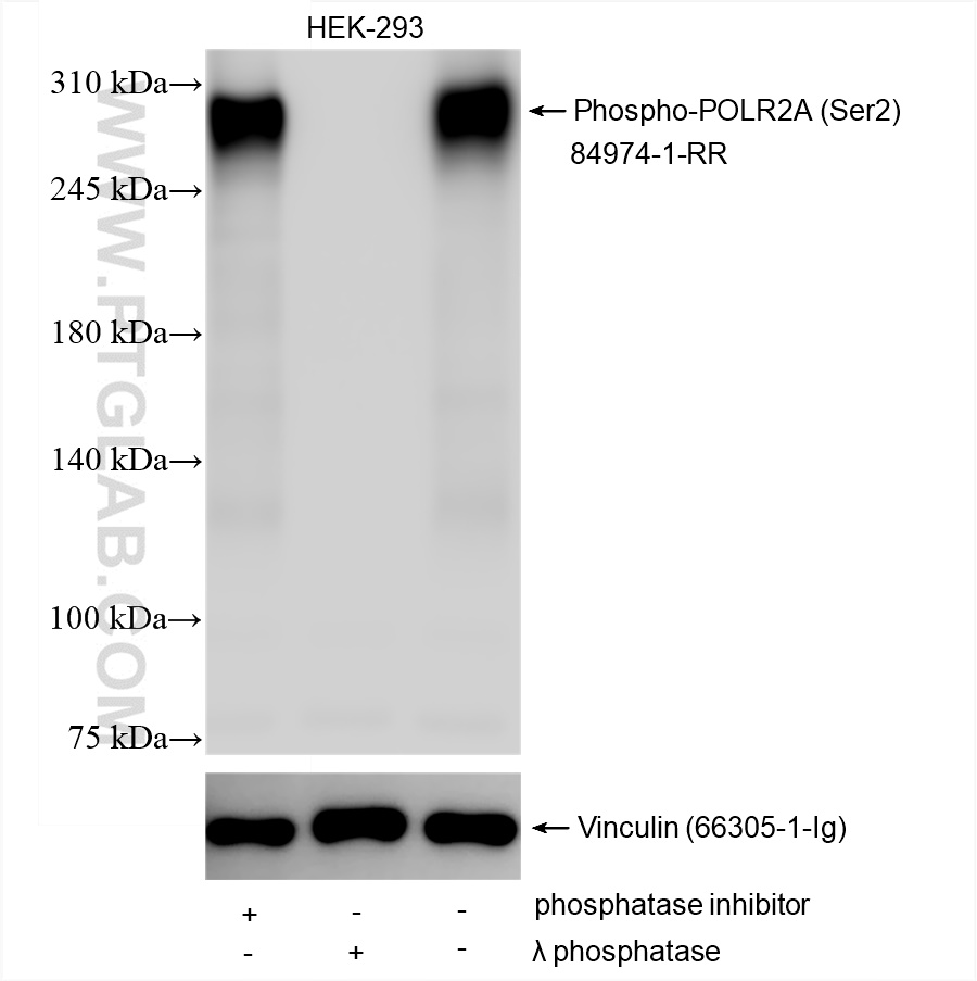 WB analysis using 84974-1-RR