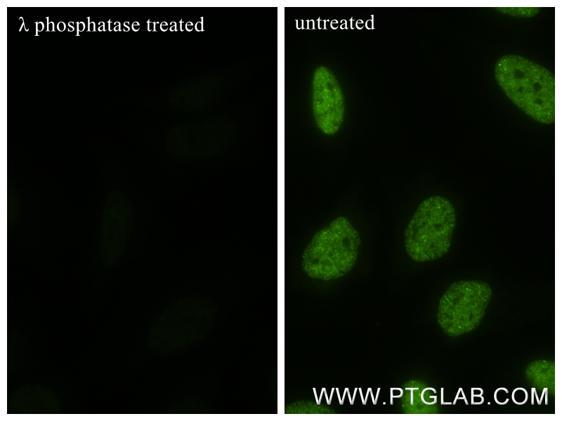 IF Staining of HeLa using 84834-1-RR