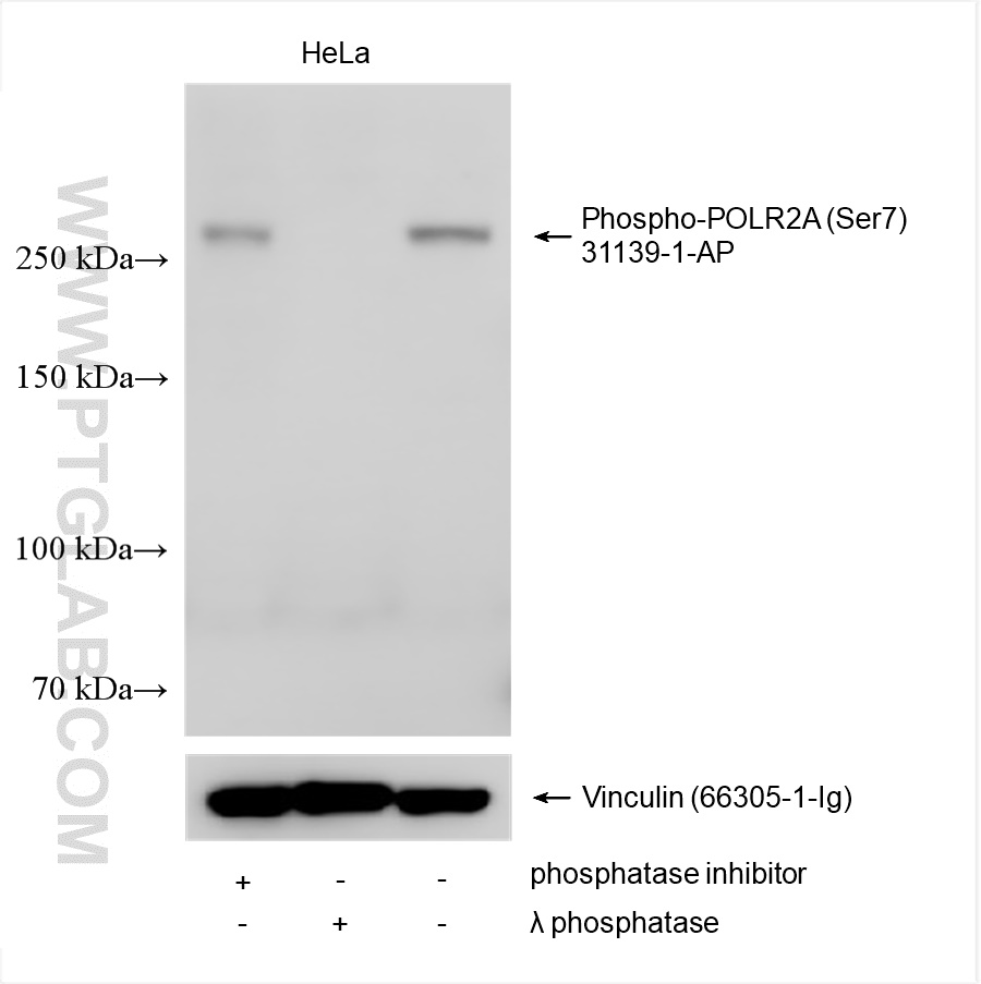 WB analysis using 31139-1-AP