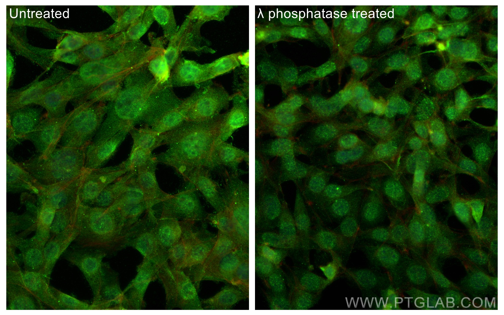 IF Staining of NIH/3T3 using 29246-1-AP