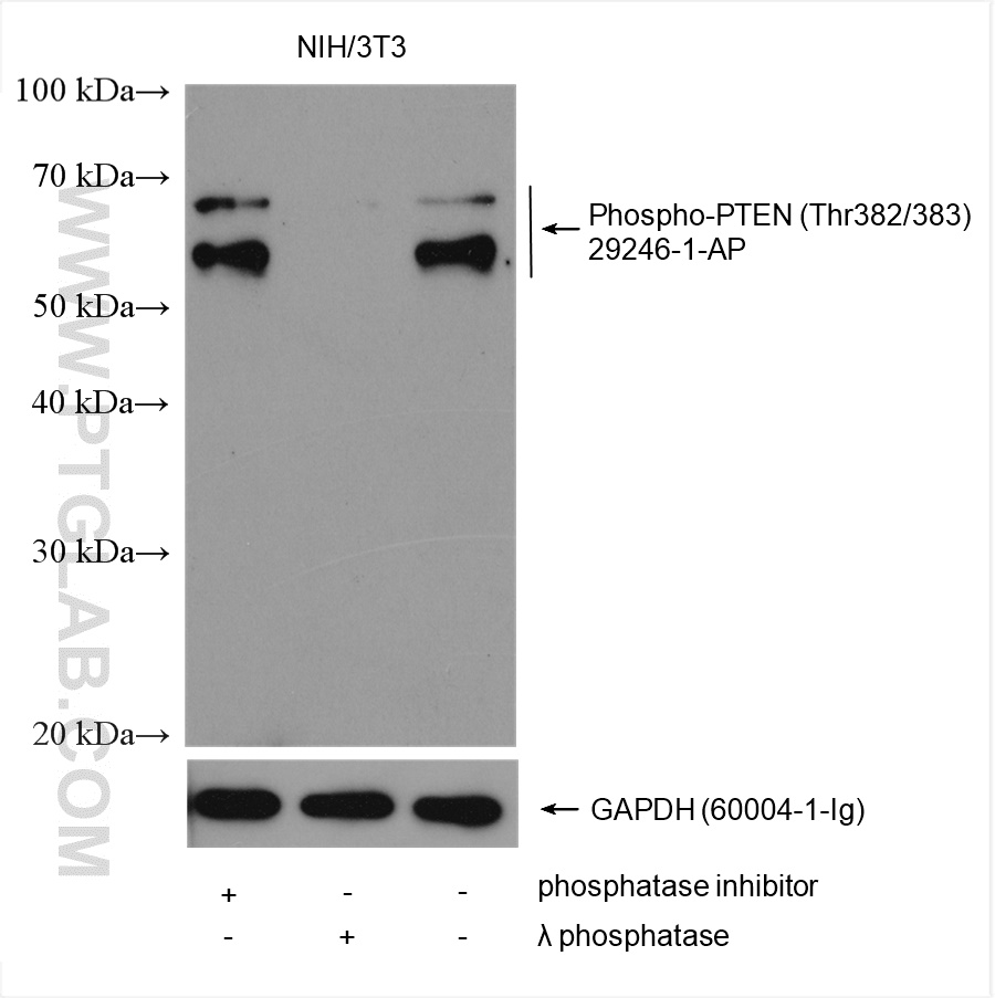 Phospho-PTEN (Thr382/383)