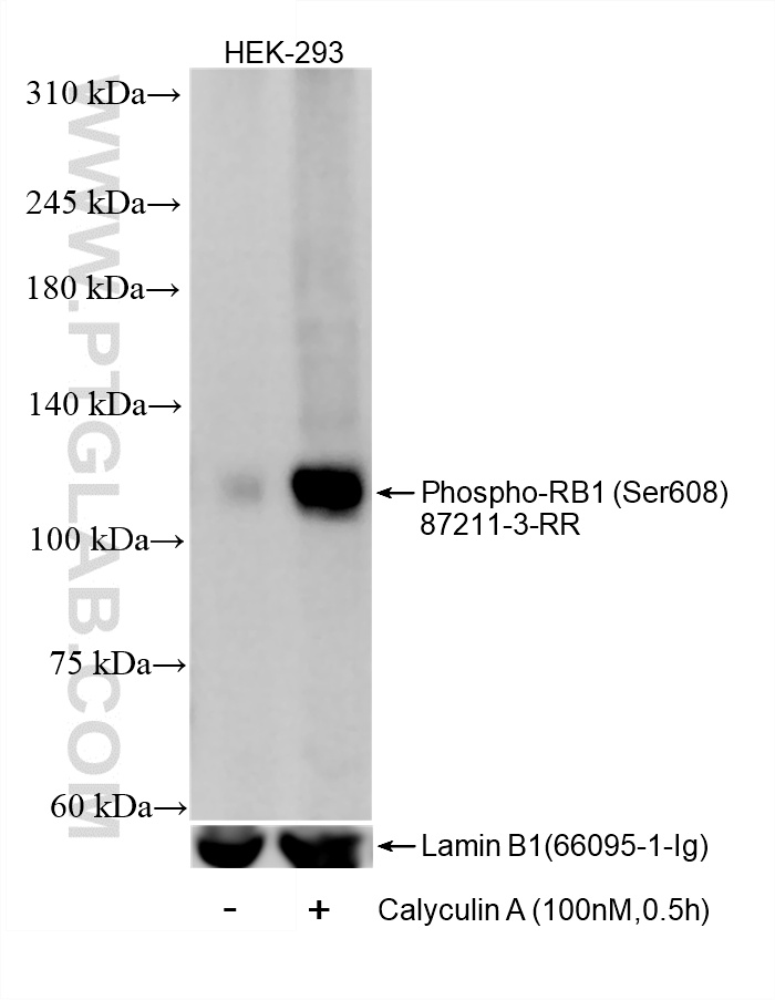 WB analysis of HEK-293 using 87211-3-RR