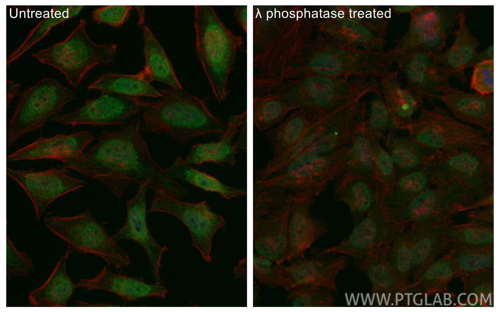 IF Staining of HeLa using CL488-84692 IF Staining of HeLa using CL488-84692