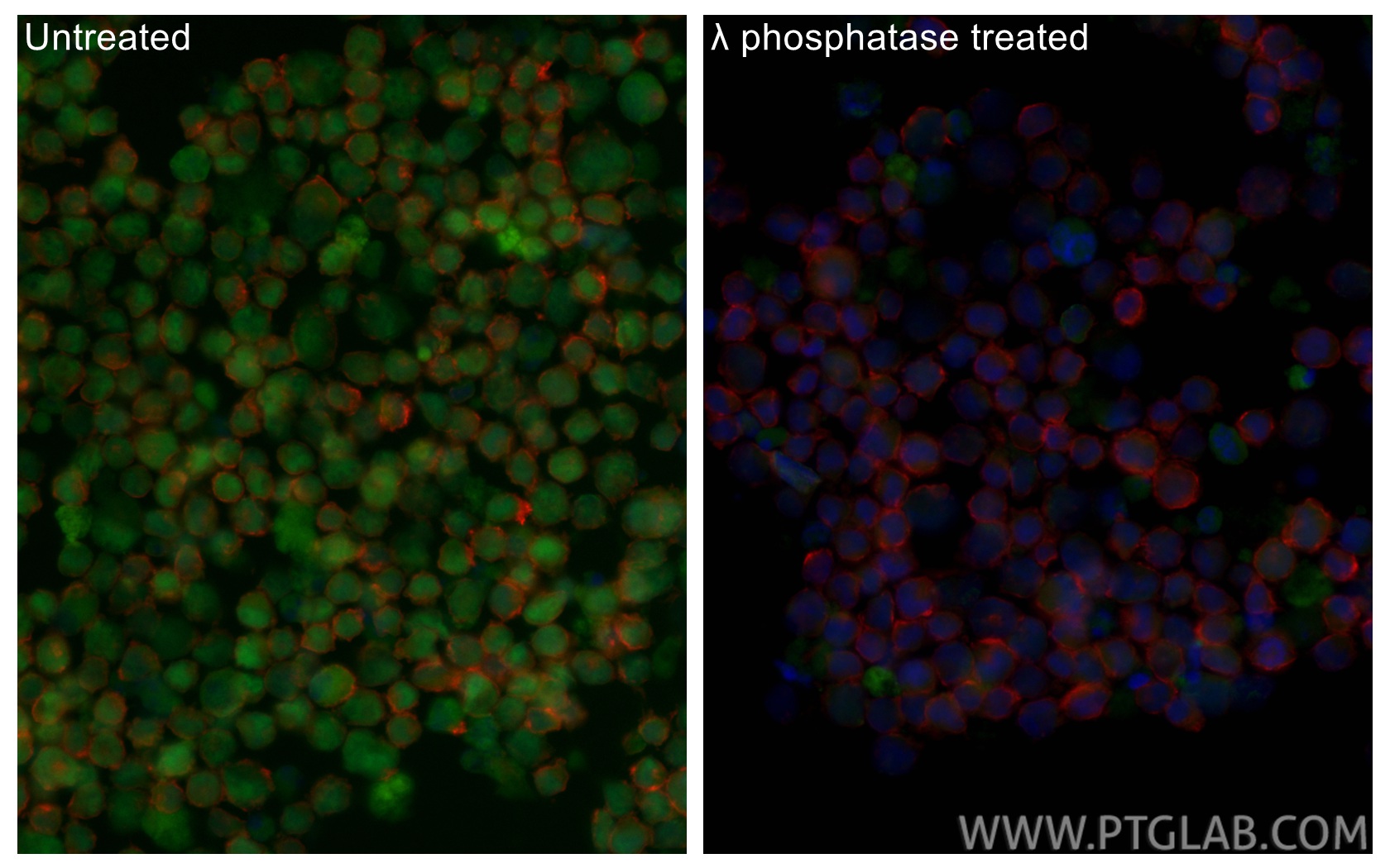 IF Staining of K-562 using CL488-84692 IF Staining of K-562 using CL488-84692