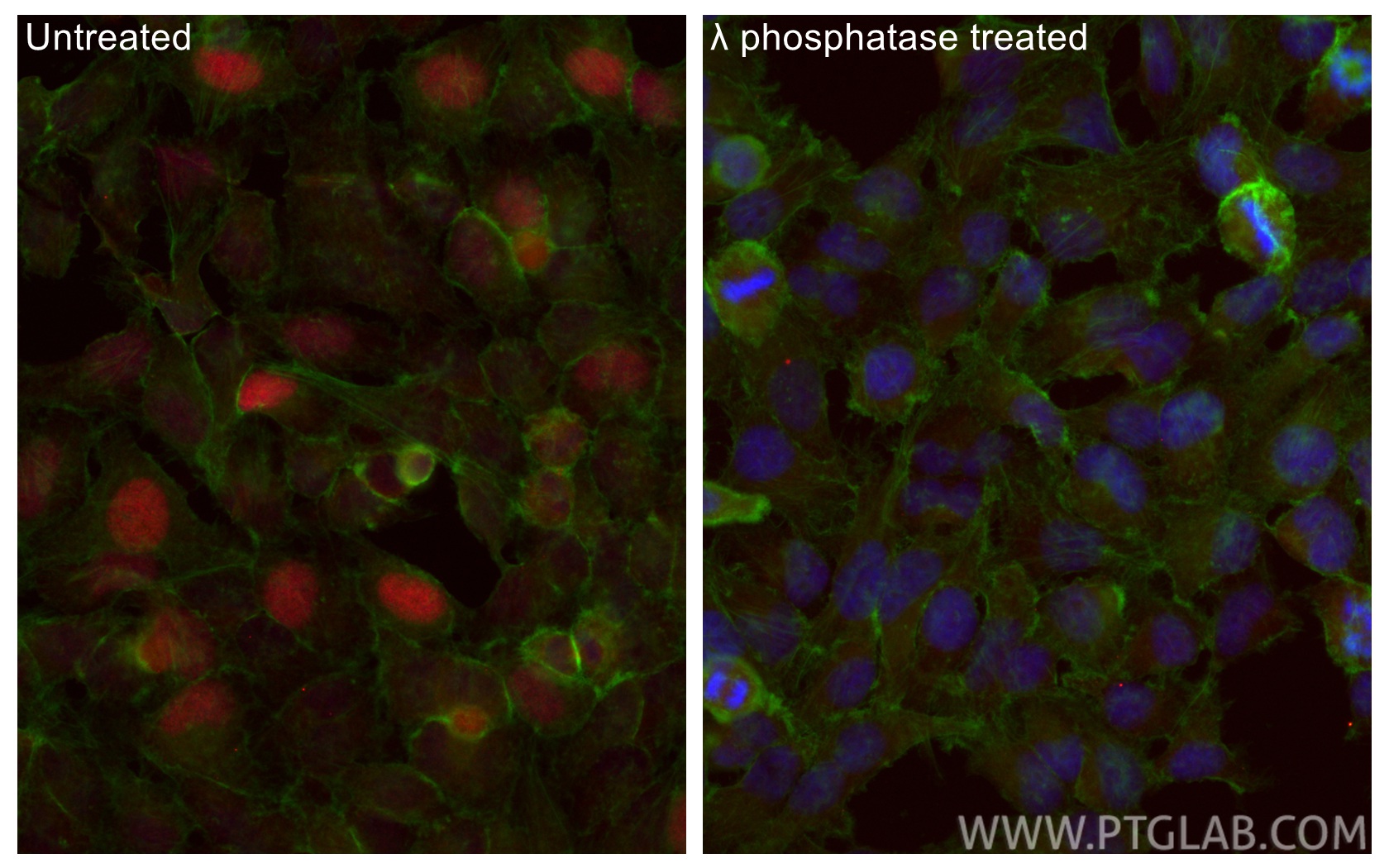 IF Staining of HeLa using CL594-84692 IF Staining of HeLa using CL594-84692
