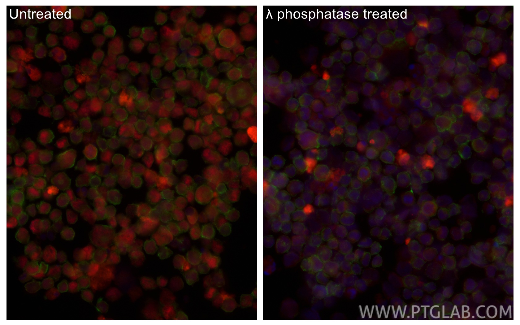 IF Staining of K-562 using CL594-84692 IF Staining of K-562 using CL594-84692