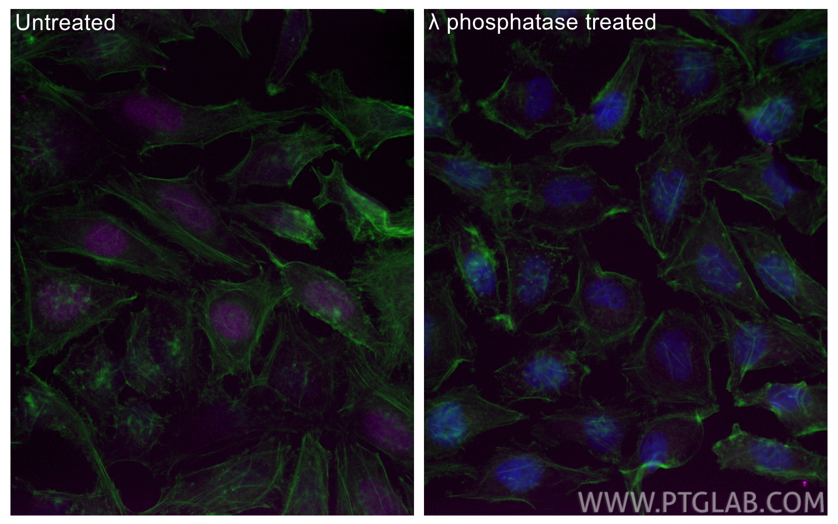 IF Staining of HeLa using CL647-84692 IF Staining of HeLa using CL647-84692
