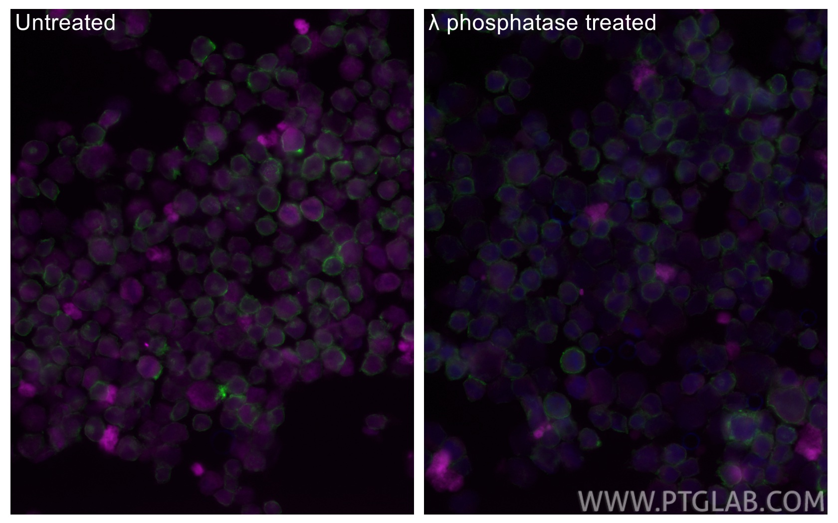IF Staining of K-562 using CL647-84692 IF Staining of K-562 using CL647-84692
