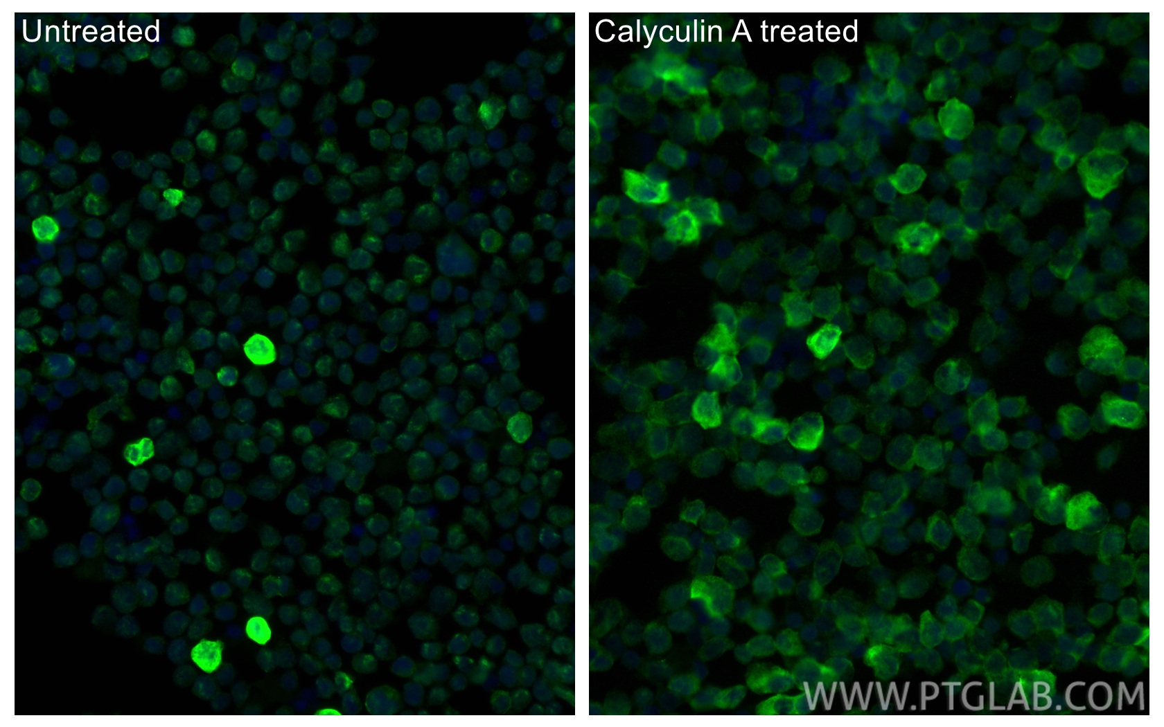 IF Staining of Jurkat using 30376-1-AP IF Staining of Jurkat using 30376-1-AP