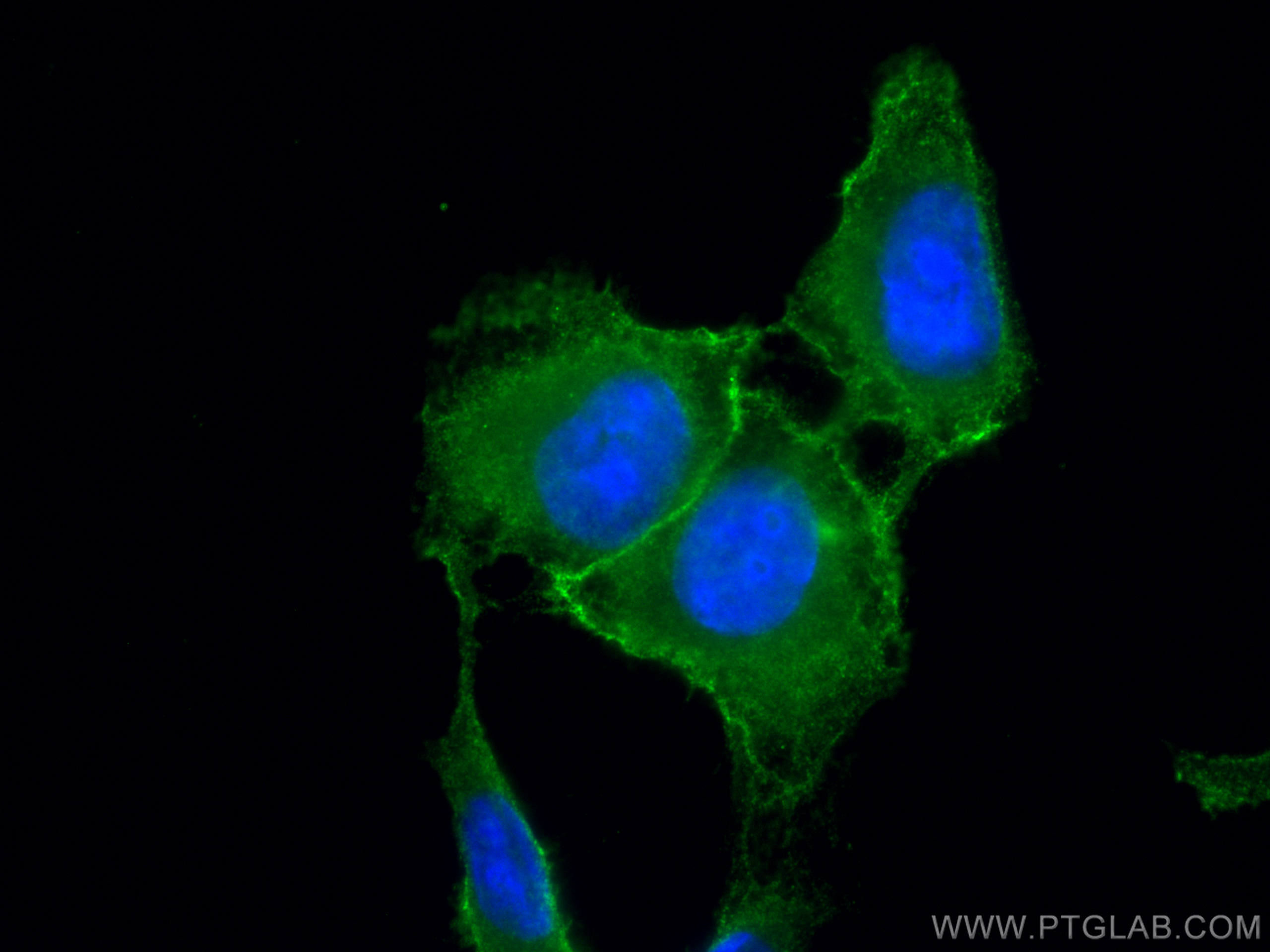 IF Staining of U2OS using CL488-66854