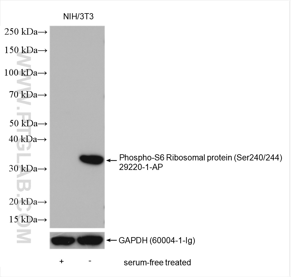 Phospho-S6 Ribosomal protein (Ser240/244)