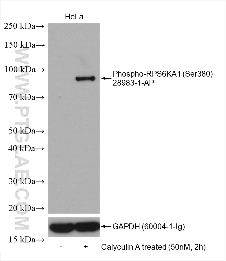 Phospho-RPS6KA1 (Ser380)