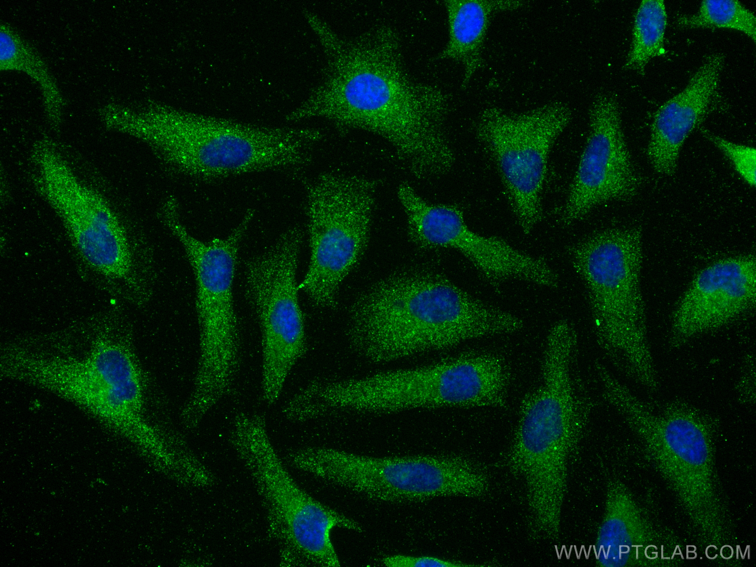 IF Staining of HeLa using 80108-1-RR (same clone as 80108-1-PBS)