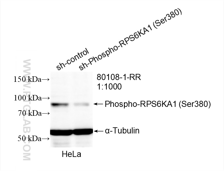 WB analysis of HeLa using 80108-1-RR (same clone as 80108-1-PBS)