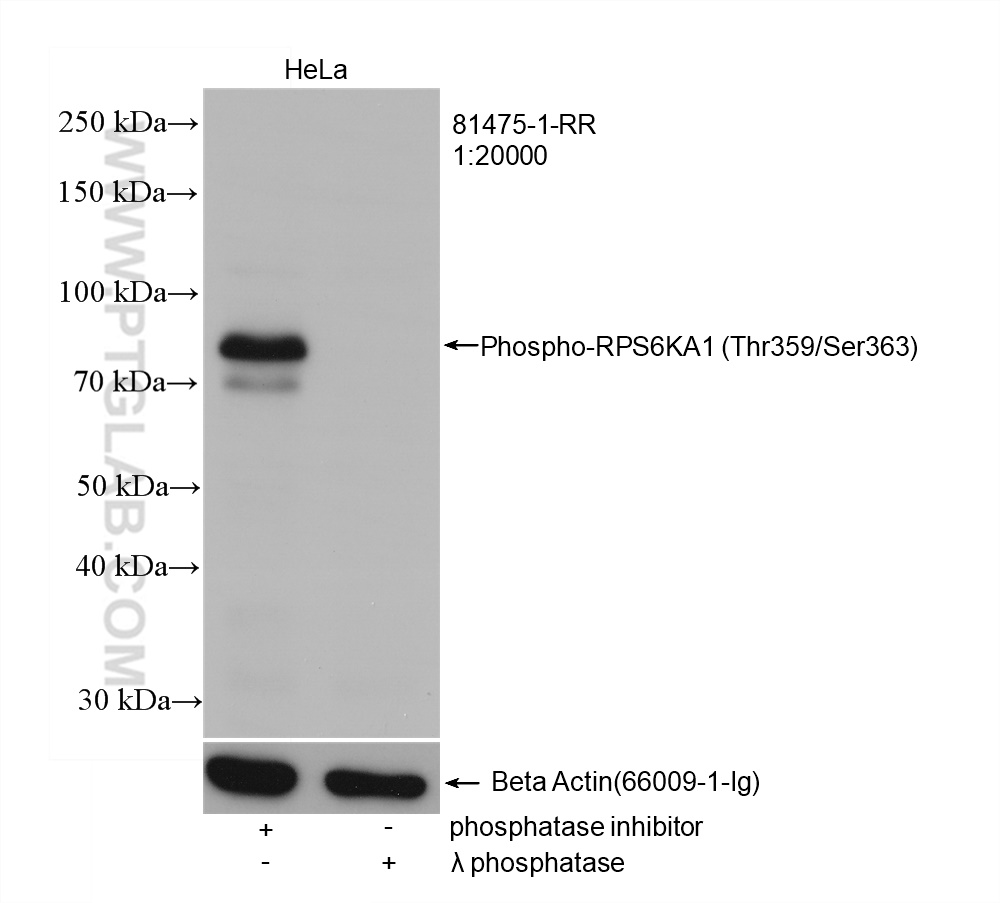 Phospho-RPS6KA1 (Thr359/Ser363)