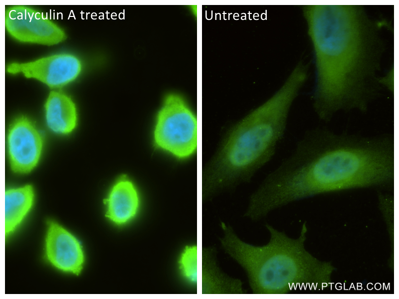 IF Staining of HeLa using 81184-1-RR (same clone as 81184-1-PBS)
