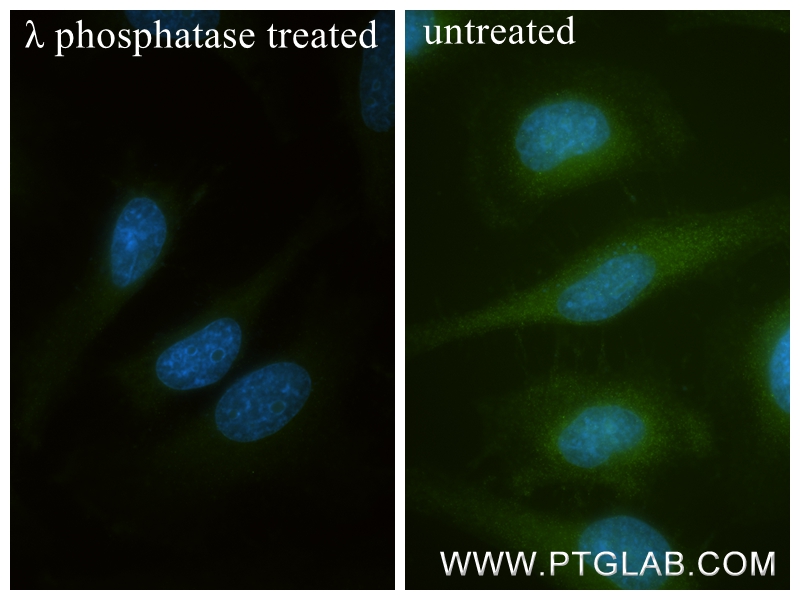 IF Staining of HeLa using 84563-1-RR
