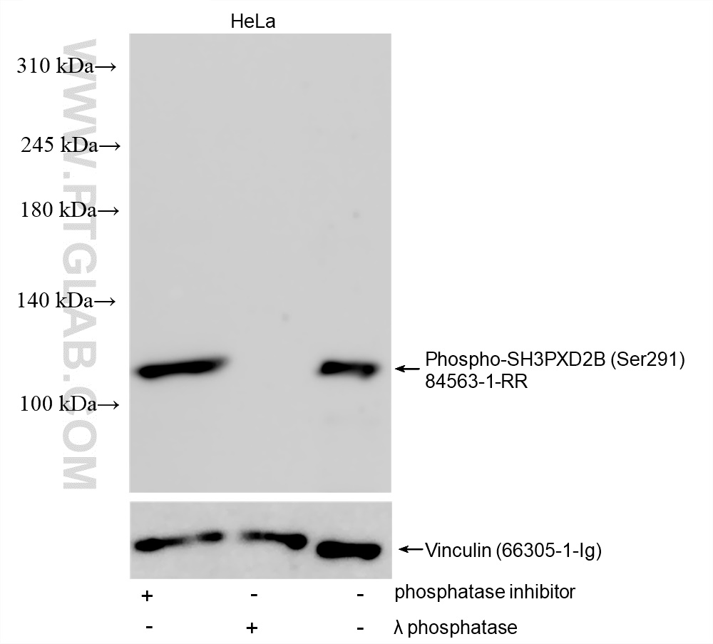 WB analysis using 84563-1-RR (same clone as 84563-1-PBS)