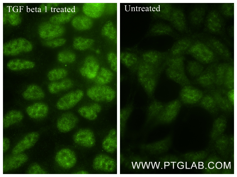IF Staining of HEK-293 using 80427-2-RR (same clone as 80427-2-PBS)