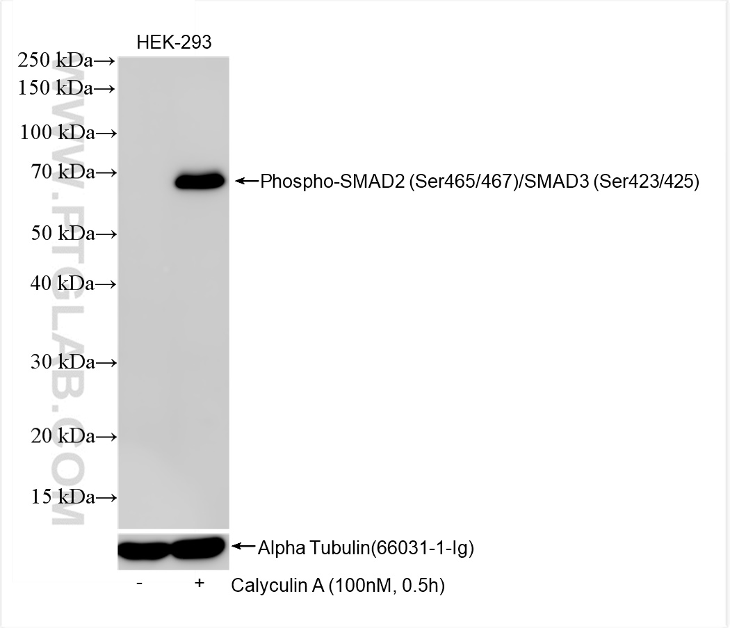 Phospho-SMAD2 (Ser465/467)/SMAD3 (Ser423/425)