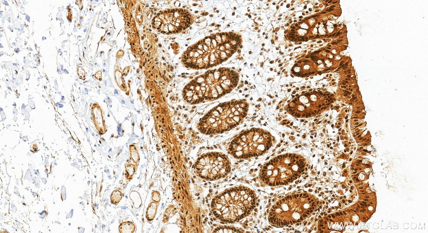 IHC staining of human colon using 80683-7-RR