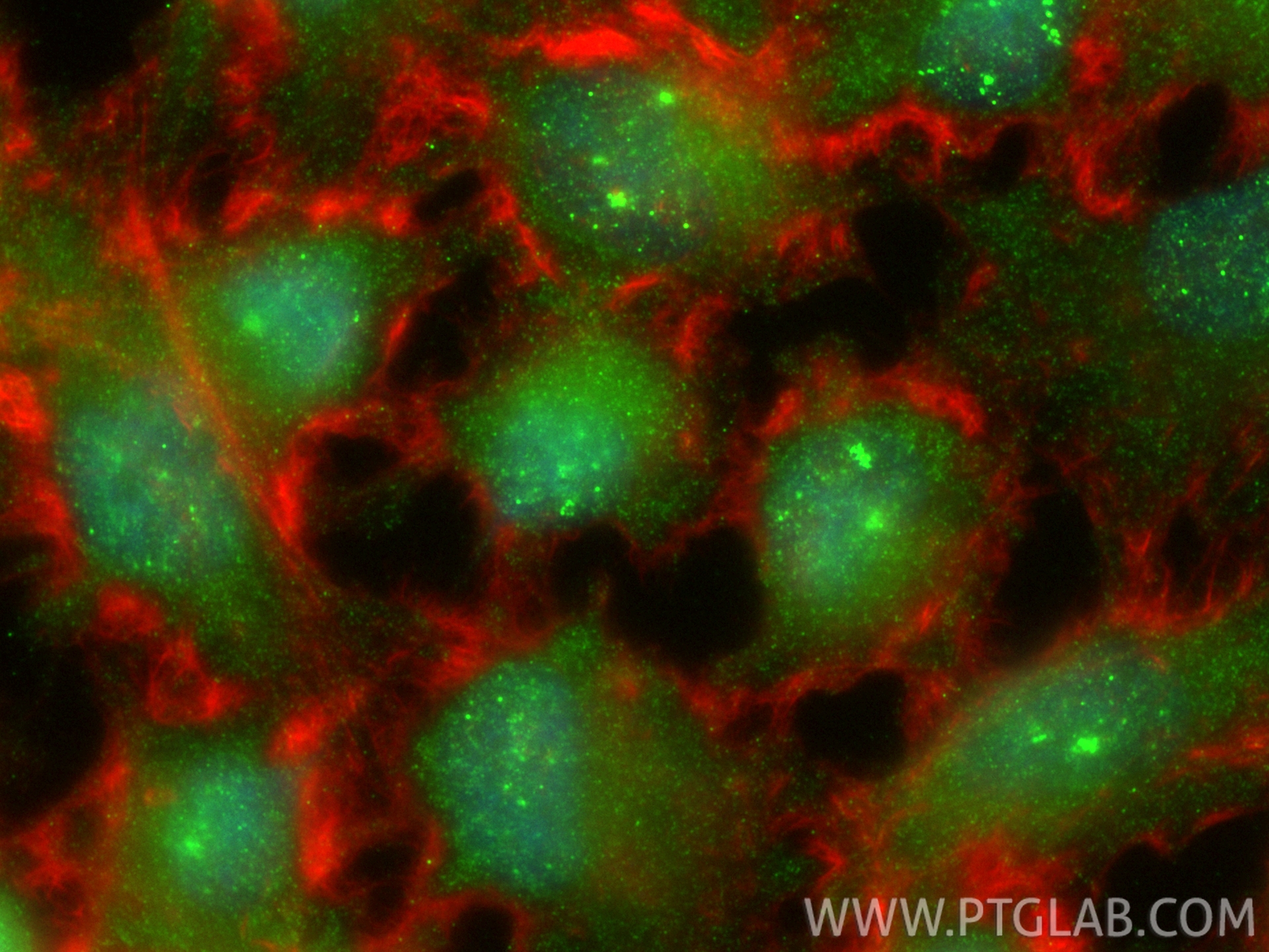 IF Staining of U-251 using 80683-7-RR (same clone as 80683-7-PBS) IF Staining of U-251 using 80683-7-RR (same clone as 80683-7-PBS)