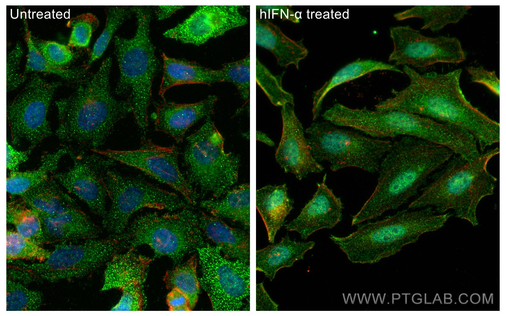 IF Staining of HeLa using 28979-1-AP