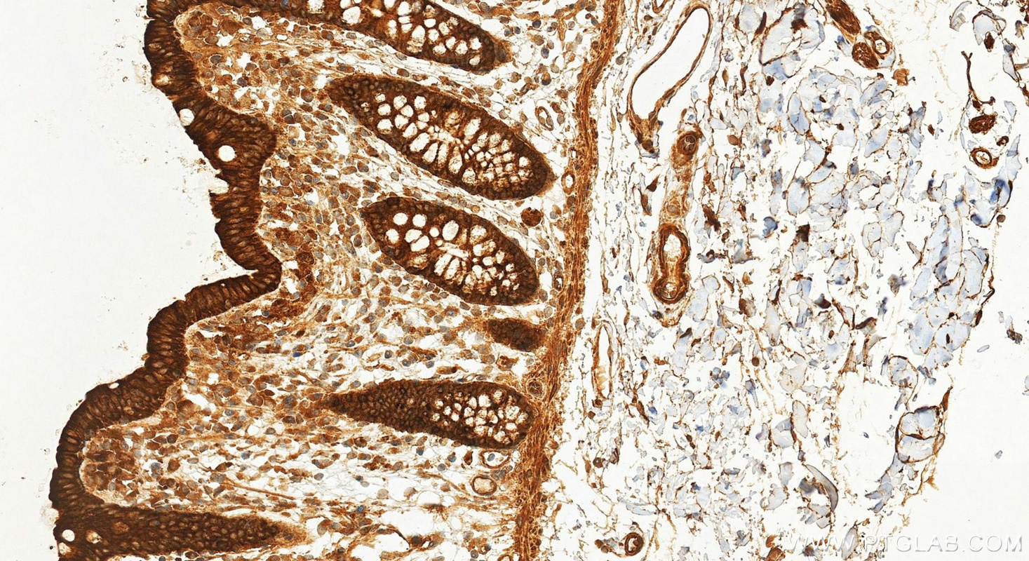 Immunohistochemical analysis of paraffin-embedded human colon tissue slide using 82674-10-RR (Phospho-STAT1 (Tyr701) antibody) at dilution of 1:400 (under 20x lens). Heat mediated antigen retrieval with Tris-EDTA buffer (pH 9.0). IHC staining of human colon using 82674-10-RR