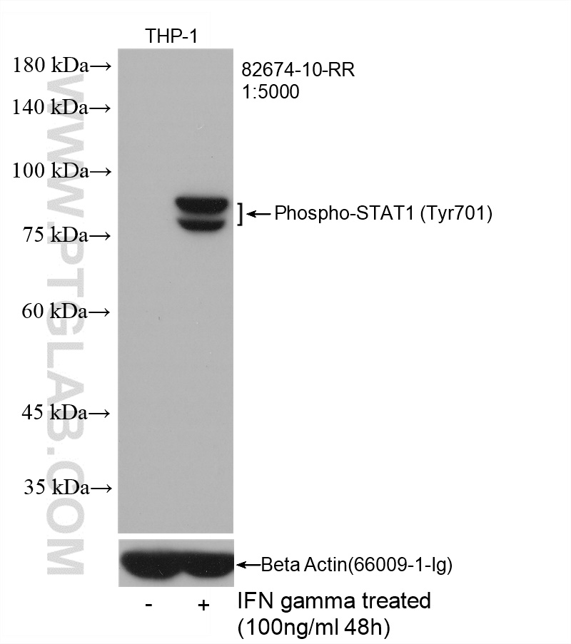 Phospho-STAT1 (Tyr701)